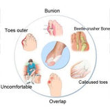 Silicone Bunion Relief Sleeves