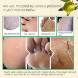 SmoothFeet Exfoliating Mask