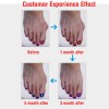 Silicone Bunion Relief Sleeves